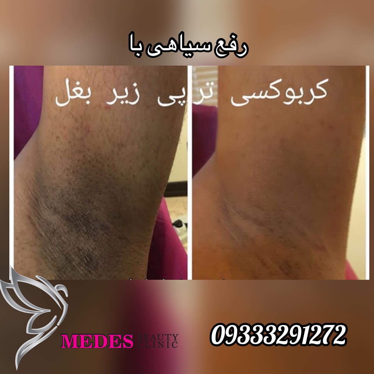 گالری کربوکسی تراپی